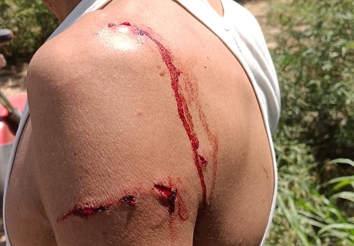 हीमपुर दीपा: गुलदार के हमले से दो किसान गंभीर रूप से घायल, ग्रामीणों में आक्रोश